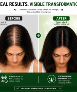 Kachita Spell Strong Hair Growth Collection Kit Shampoo, Hair Mask & Serum with Biotin, Onion, Rosemary, Ginger, Cinnamon & Bay Leaf Hair Care - Image 8