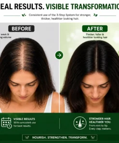 Kachita Spell Strong Hair Growth Collection Kit – Shampoo, Mascarilla Capilar y Sérum con Biotina, Cebolla, Romero, Jengibre, Canela y Hoja de Laurel para el Crecimiento del Cabello - Imagen 8