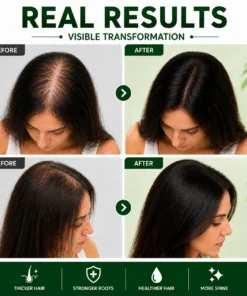 Kachita Spell Strong Hair Growth Collection Kit – Shampoo, Mascarilla Capilar y Sérum con Biotina, Cebolla, Romero, Jengibre, Canela y Hoja de Laurel para el Crecimiento del Cabello - Imagen 3